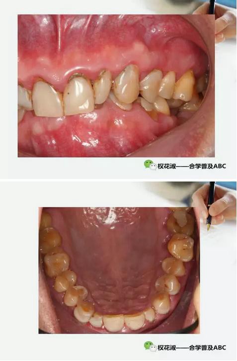 360截圖20170121133657664.jpg 360截圖20170121133657664.jpg