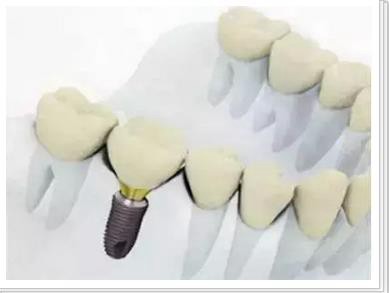 360截圖20170121143508907.jpg 360截圖20170121143508907.jpg