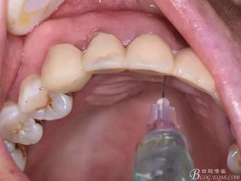 360截圖20170121151703488.jpg 360截圖20170121151703488.jpg