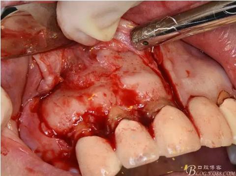 360截圖20170121151725725.jpg 360截圖20170121151725725.jpg