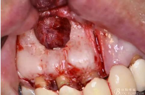 360截圖20170121152134117.jpg 360截圖20170121152134117.jpg