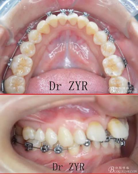360截圖20170121171227043.jpg 360截圖20170121171227043.jpg