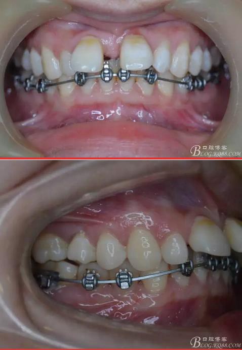 360截圖20170121171252204.jpg 360截圖20170121171252204.jpg