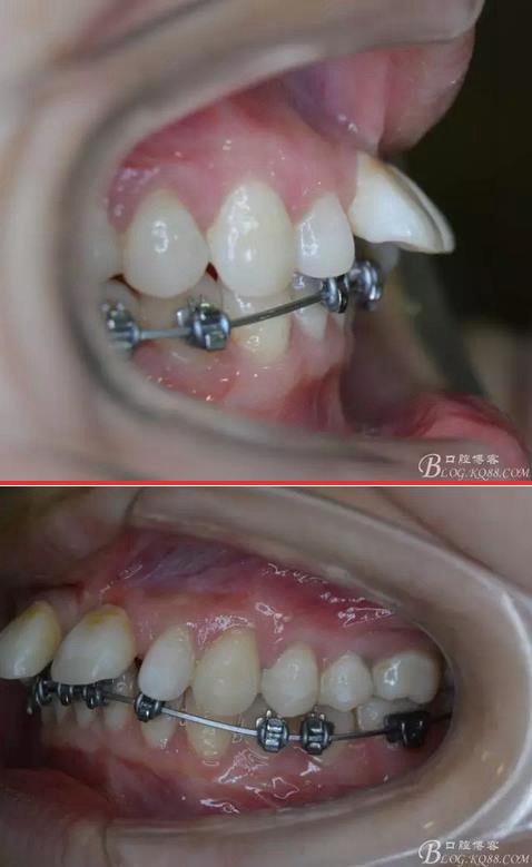 360截圖20170121171307250.jpg 360截圖20170121171307250.jpg