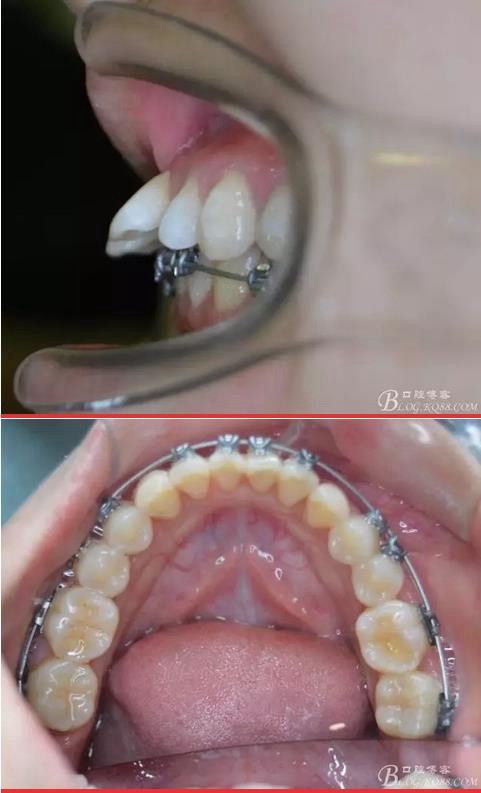 360截圖20170121171322323.jpg 360截圖20170121171322323.jpg