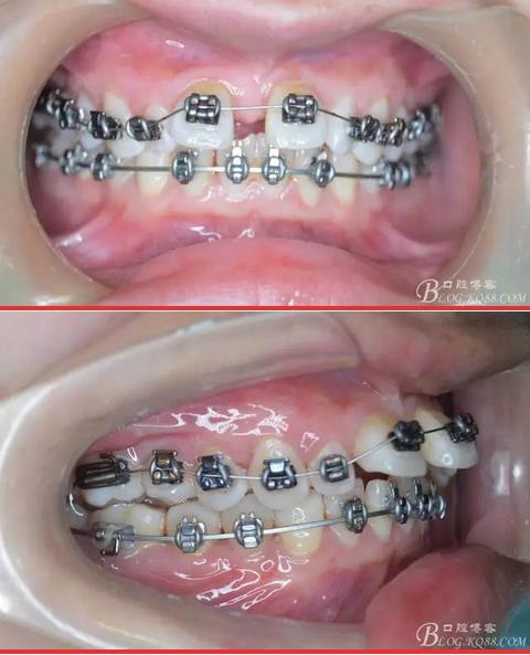 360截圖20170121171334219.jpg 360截圖20170121171334219.jpg