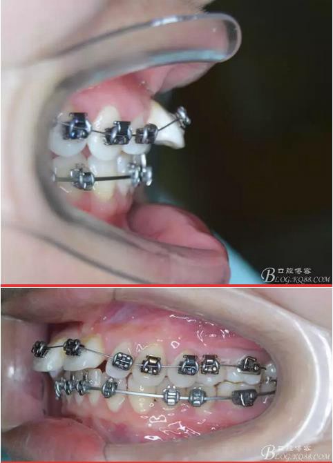 360截圖20170121171346826.jpg 360截圖20170121171346826.jpg