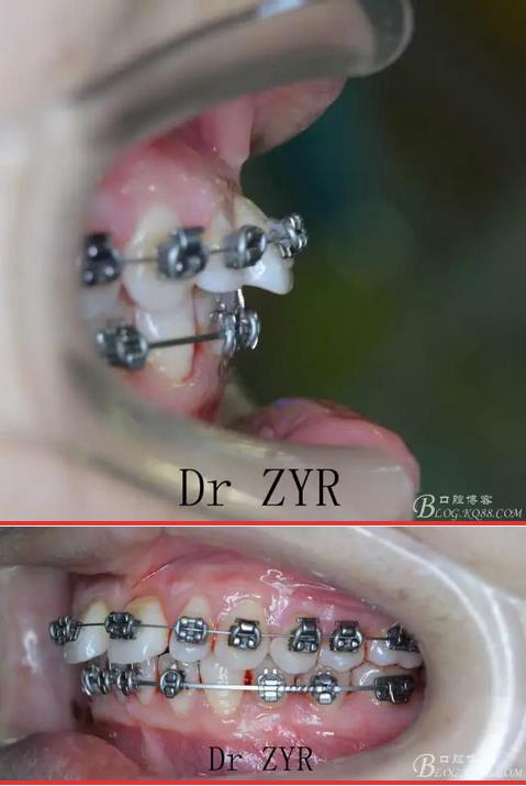 360截圖20170121171738947.jpg 360截圖20170121171738947.jpg