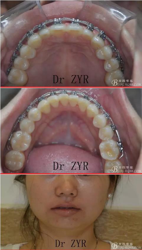 360截圖20170121171814811.jpg 360截圖20170121171814811.jpg