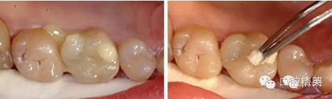 360截圖20170122092711314.jpg 360截圖20170122092711314.jpg