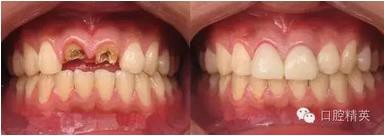 360截圖20170122101129580.jpg 360截圖20170122101129580.jpg