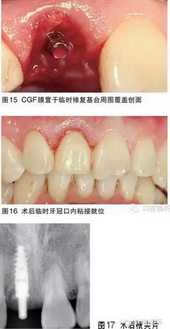 360截圖20170122103902767.jpg 360截圖20170122103902767.jpg