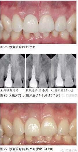 360截圖20170122104028150.jpg 360截圖20170122104028150.jpg