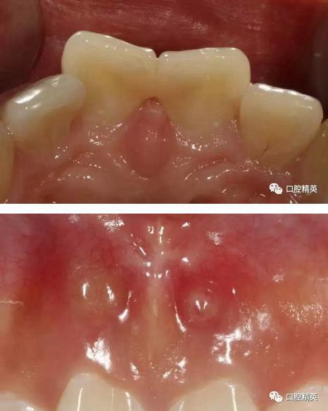 360截圖20170122111133520.jpg 360截圖20170122111133520.jpg