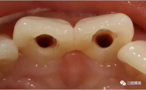 360截圖20170122111227736.jpg 360截圖20170122111227736.jpg