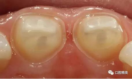 360截圖20170122111236960.jpg 360截圖20170122111236960.jpg