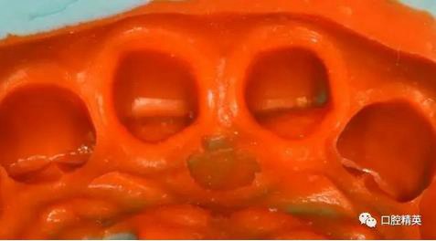 360截圖20170122111259208.jpg 360截圖20170122111259208.jpg