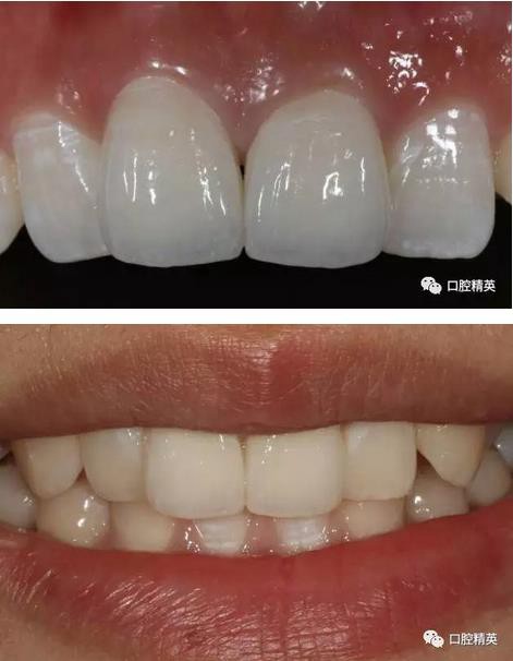 360截圖20170122111413913.jpg 360截圖20170122111413913.jpg