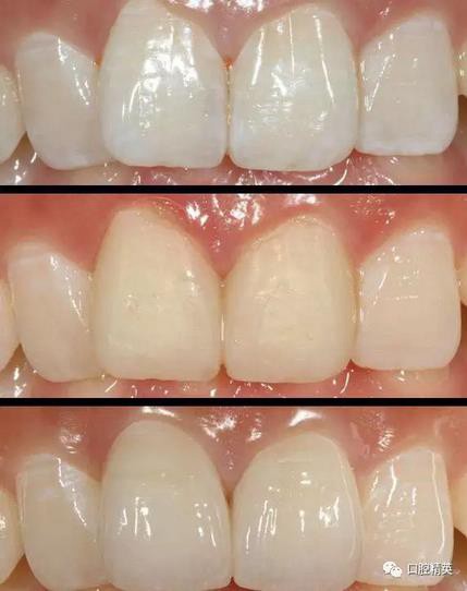 360截圖20170122111505304.jpg 360截圖20170122111505304.jpg