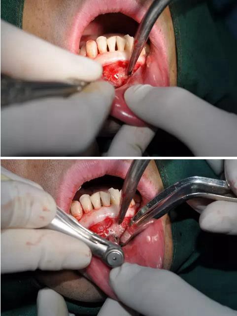 360截圖20170123090027788.jpg 360截圖20170123090027788.jpg