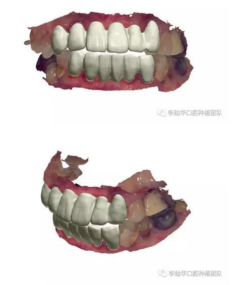 360截圖20170123093625758.jpg 360截圖20170123093625758.jpg