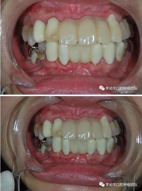 360截圖20170123093659294.jpg 360截圖20170123093659294.jpg