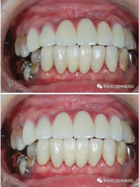 360截圖20170123093709957.jpg 360截圖20170123093709957.jpg