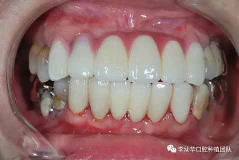 360截圖20170123093735734.jpg 360截圖20170123093735734.jpg