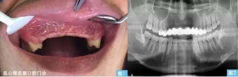 360截圖20170123095054735.jpg 360截圖20170123095054735.jpg