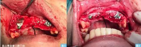 360截圖20170123095114015.jpg 360截圖20170123095114015.jpg