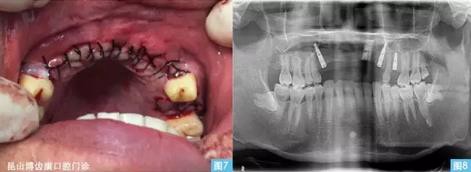 360截圖20170123095122654.jpg 360截圖20170123095122654.jpg