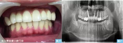 360截圖20170123095234966.jpg 360截圖20170123095234966.jpg