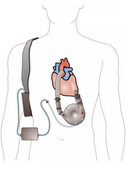 360截圖20170123155623640.jpg 360截圖20170123155623640.jpg