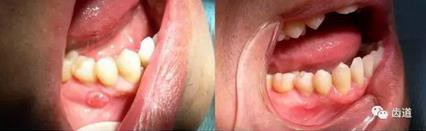 360截圖20170123160452720.jpg 360截圖20170123160452720.jpg