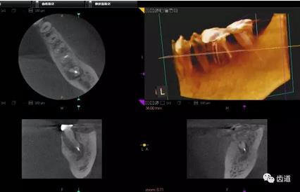 360截圖20170123161243073.jpg 360截圖20170123161243073.jpg