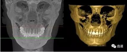 360截圖20170123164828582.jpg 360截圖20170123164828582.jpg