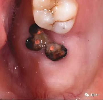 360截圖20170124104239702.jpg 360截圖20170124104239702.jpg