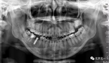 360截圖20170124104248781.jpg 360截圖20170124104248781.jpg