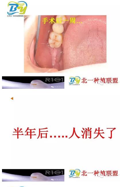 360截圖20170124112659489.jpg 360截圖20170124112659489.jpg