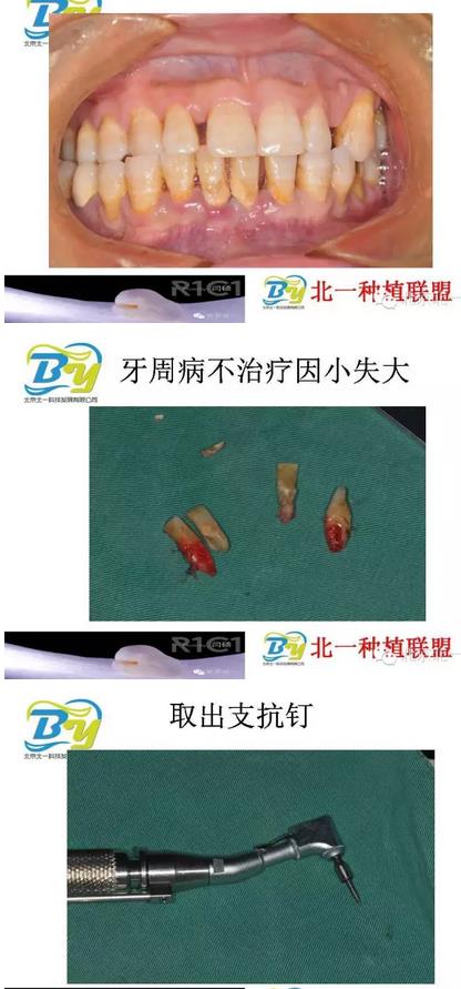 360截圖20170124112724720.jpg 360截圖20170124112724720.jpg