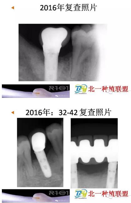 360截圖20170124112823232.jpg 360截圖20170124112823232.jpg