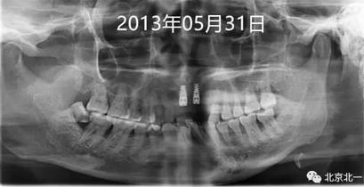 360截圖20170124115120121.jpg 360截圖20170124115120121.jpg