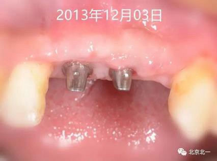 360截圖20170124115147089.jpg 360截圖20170124115147089.jpg