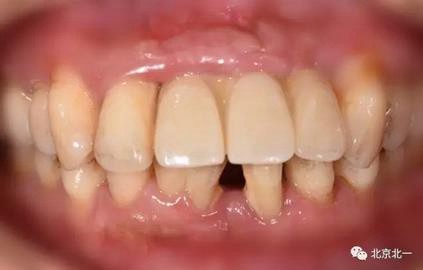 360截圖20170124115223114.jpg 360截圖20170124115223114.jpg