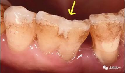 360截圖20170124115314561.jpg 360截圖20170124115314561.jpg