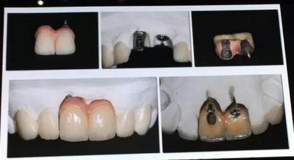 360截圖20170125150522735.jpg 360截圖20170125150522735.jpg