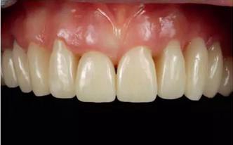 360截圖20170125151245091.jpg 360截圖20170125151245091.jpg