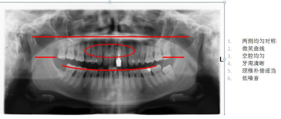 0ND0IA((WVNCD~OMT~`GR9D.png 0ND0IA((WVNCD~OMT~`GR9D.png