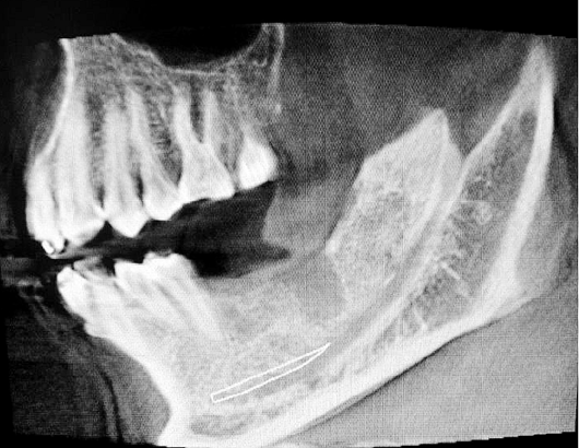 PMYBX6C51FFEUFK3P19${CG.png PMYBX6C51FFEUFK3P19${CG.png