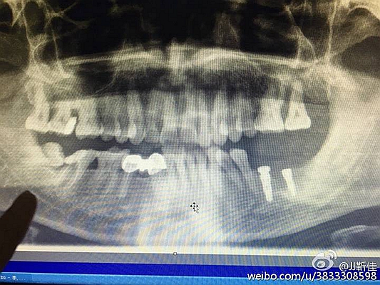 e47ba5b6jw1f6hrcako8ej20ku0fm782.jpg e47ba5b6jw1f6hrcako8ej20ku0fm782.jpg